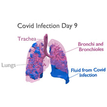 Load image into Gallery viewer, Covid Lung Model
