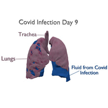 Load image into Gallery viewer, Covid Lung Model
