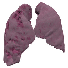 Load image into Gallery viewer, Covid Lung Model