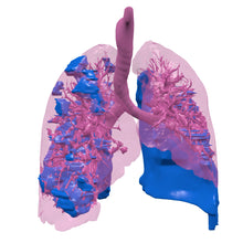 Load image into Gallery viewer, Covid Lung Model
