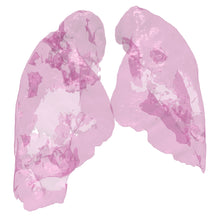 Load image into Gallery viewer, Covid Lung Model
